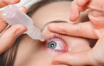 Viral Conjunctivitis vs. Bacterial Conjunctivitis